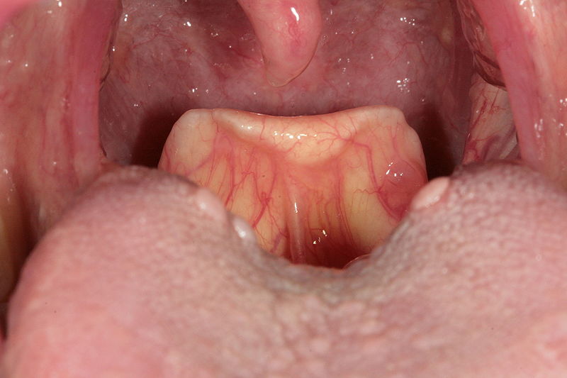 Apa Fungsi Epiglotis