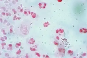 Bakteri Metanogen